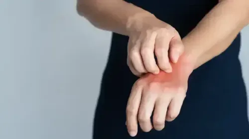 Causes of Your Uncontrollable Skin Irritation